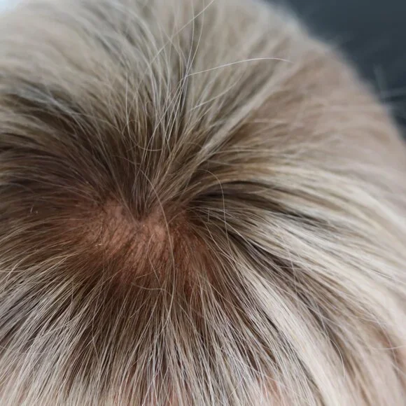 Human Hair Topper - Picture 2 of 7